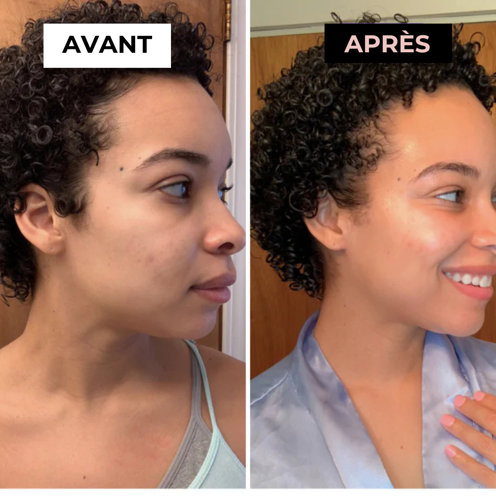 Noreska™ : Révélez Votre Éclat Naturel