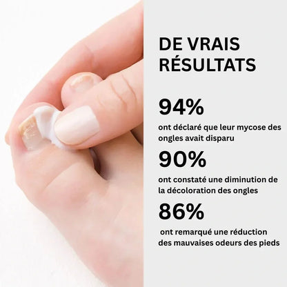 Adieu les Mycoses : Gel Réparateur pour Ongles Sains